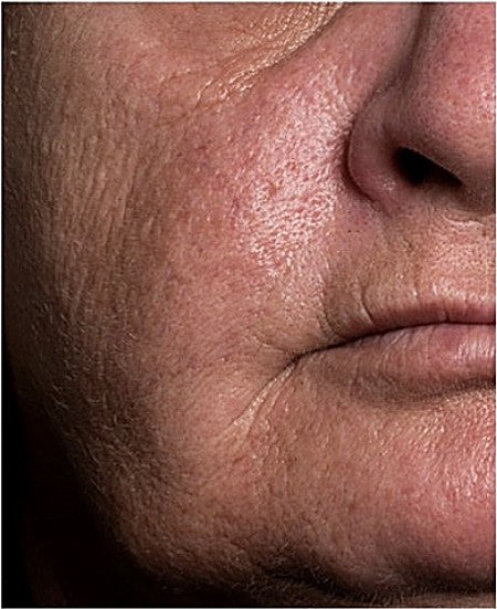 Customer skin before using Alkaglam